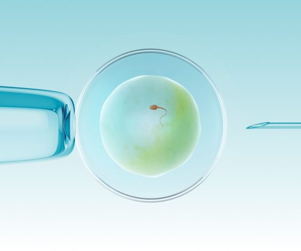 ivf