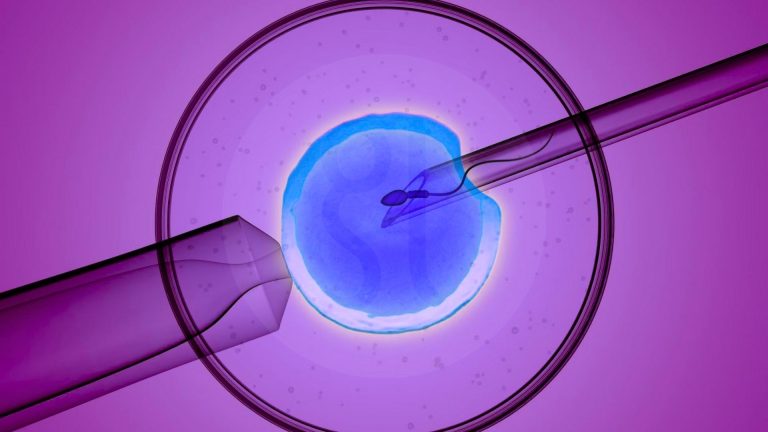 Mikrochip IVF
