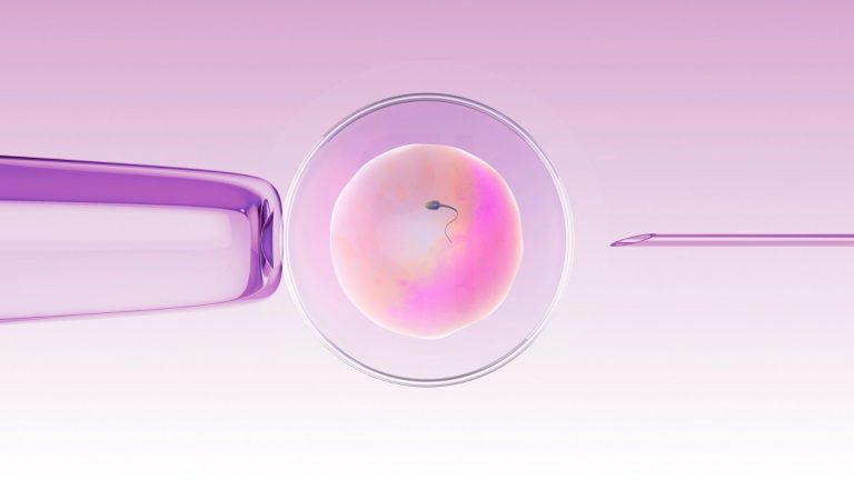 Tandem-IVF